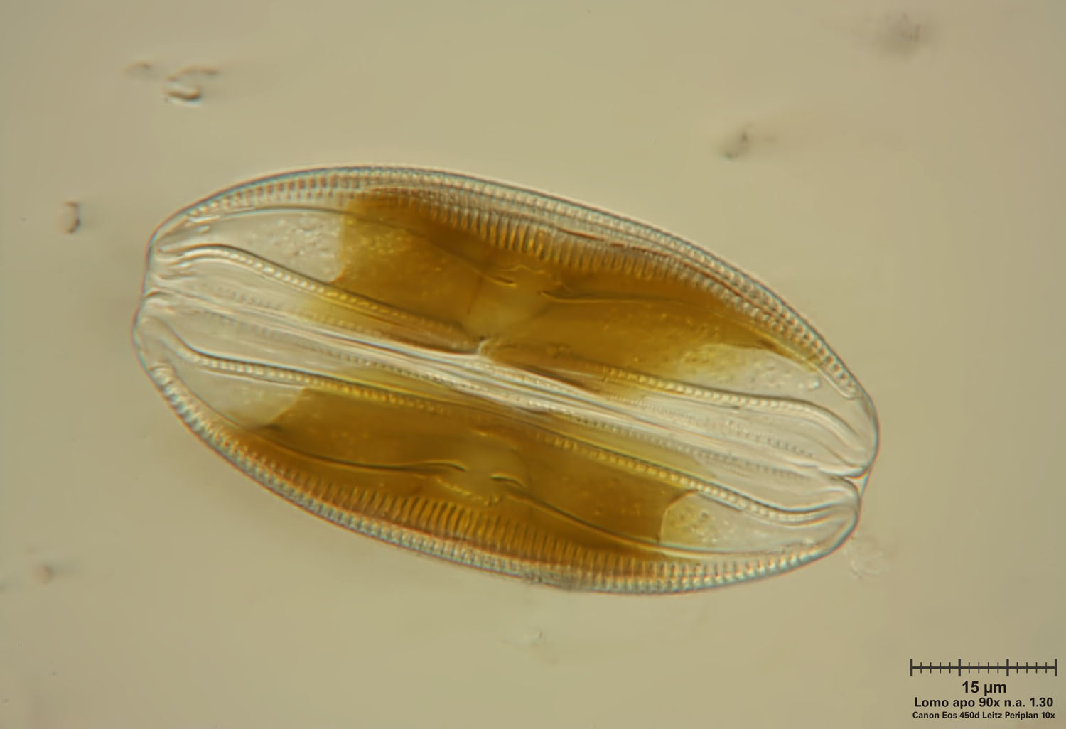 Amphora ovalis
